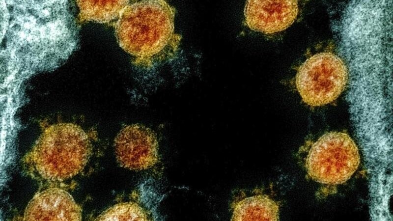 Experten gehen davon aus, dass wir das Coronavirus Sars-CoV-2 nicht wieder loswerden.