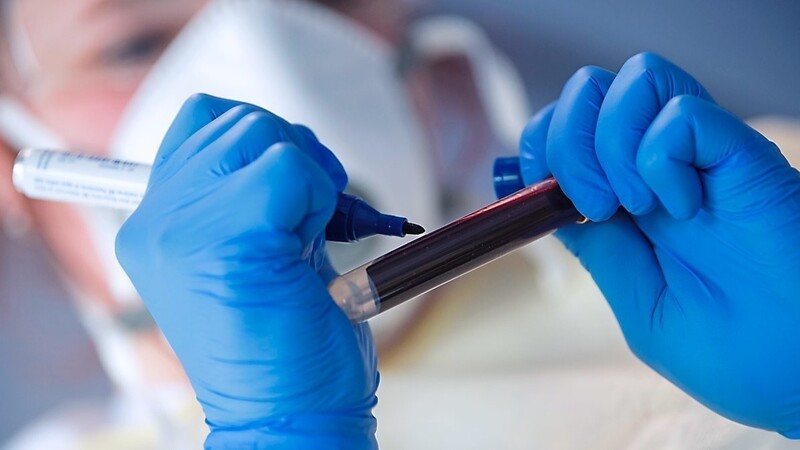 Eine Mitarbeiterin des Robert Koch-Instituts (RKI) beschriftet eine Blutprobe für einen Antikörpertest.