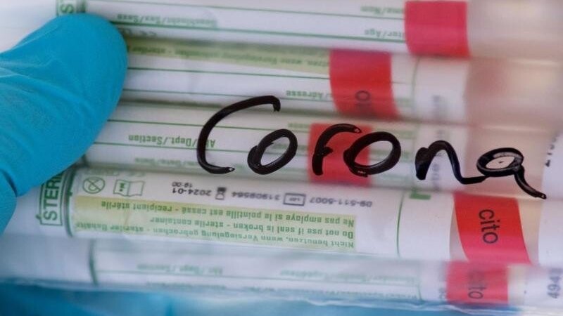 Proben für Corona-Tests werden untersucht. (Symbolbild)