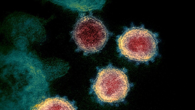 Diese elektronenmikroskopische Aufnahme des U.S. National Institutes of Health zeigt das Virus, das Covid-19 verursacht.