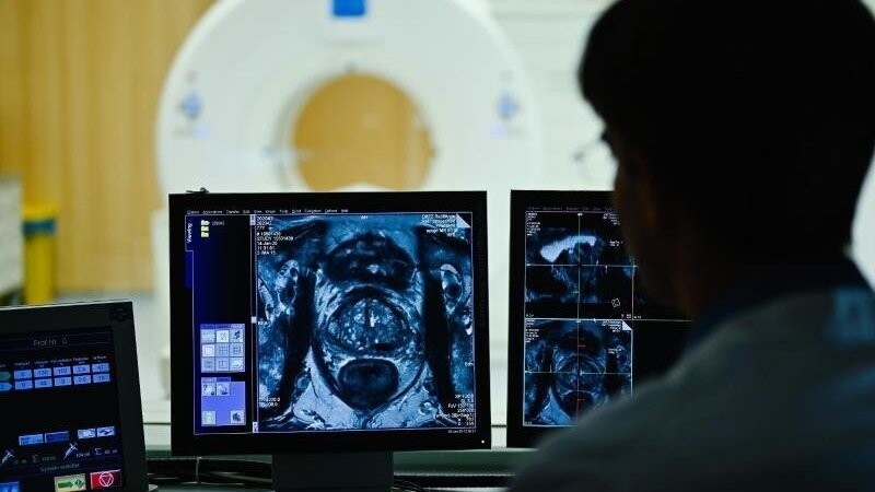 Ein Mitarbeiter betrachtet in einem Kontrollraum des Deutschen Krebsforschungszentrum (DKFZ) auf einem Monitor das Querschnittsbild einer Prostata.