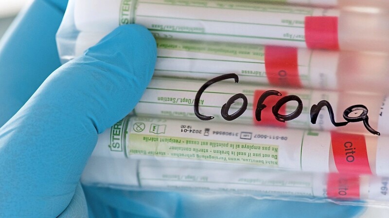 In Bayern können sich ab Juli alle Bürger gratis auf Corona testen lassen - auch ohne Symptome.
