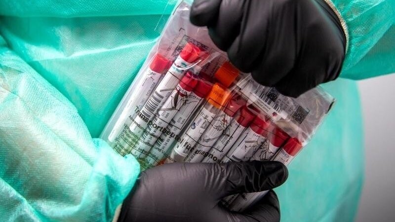 Proben für einen PCR-Test werden von einem Laboranten verpackt.