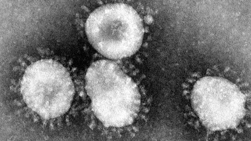 Ein Coronavirus unter dem Mikroskop. Dieses kleine Lebewesen hat den Landkreis noch immer fest im Griff.