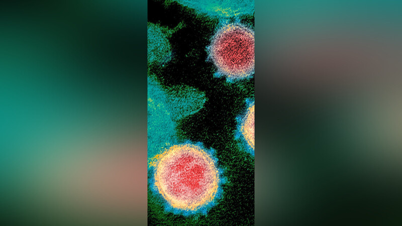 Eine elektronenmikroskopische Aufnahme des US-amerikanischen Gesundheitsministeriums zeigt das Virus, das Covid-19 verursacht.