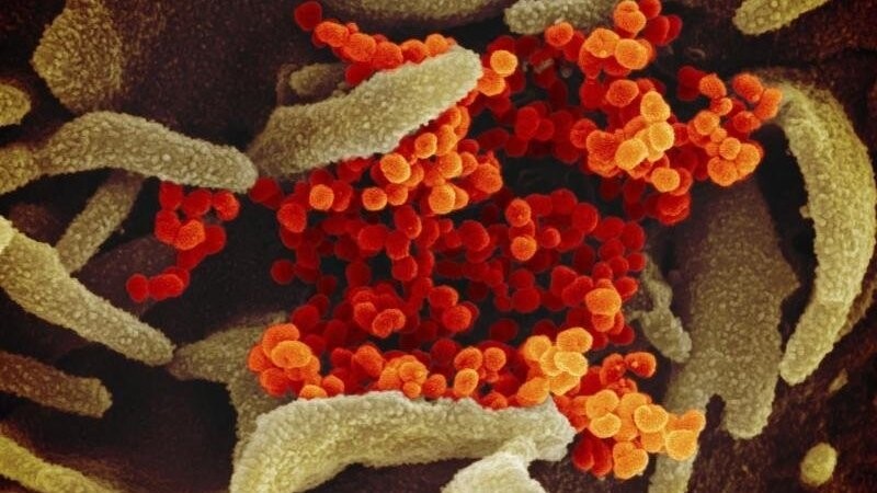 So sieht das Coronavirus unter dem Elektronenmikroskop aus.