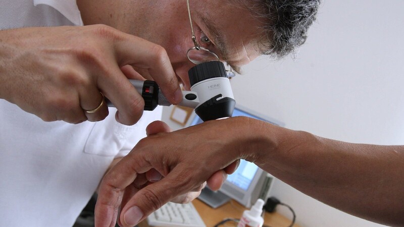 Ein Hautarzt untersucht am 25.06.2008 in seiner Praxis in Buchloe (Bayern) mit einem Vergrößerungsglas die Haut einer Patientin bei einer Hautkrebs-Früherkennung.