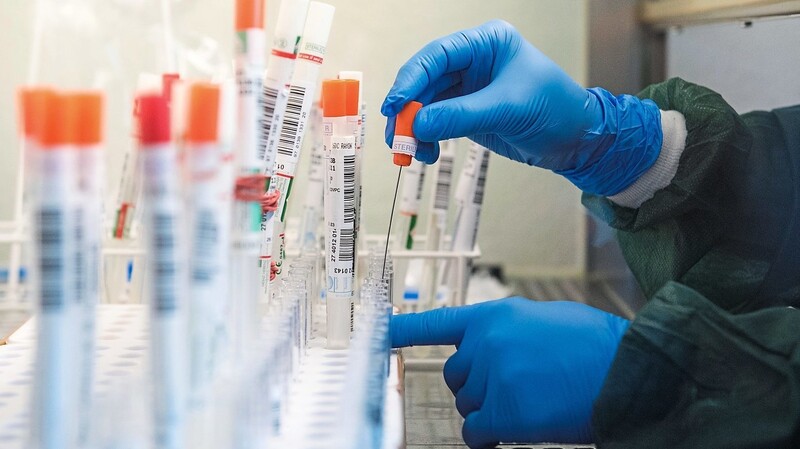 Eine Mitarbeiterin eines Labors überführt einen Abstrich eines molekularbiologischen Tests auf das Corona-Virus in eine Flüssigkeit.