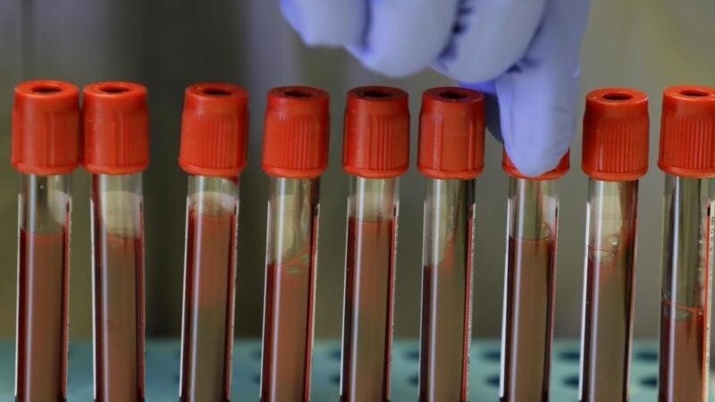Blutproben von Freiwilligen in einem Labor. Boehringer Ingelheim will gemeinsam mit zahlreichen weiteren Firmen und Forschungseinrichtungen die Suche nach einem Medikament gegen Covid-19 beschleunigen. (Symbolbild)