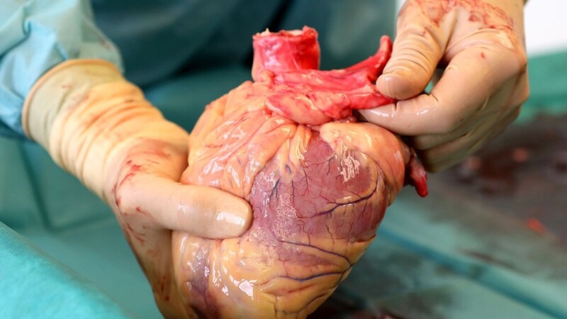 Ein Transplantationsmediziner hält das Herz eines Verstorbenen in den Händen, kurz nachdem es entnommen wurde.