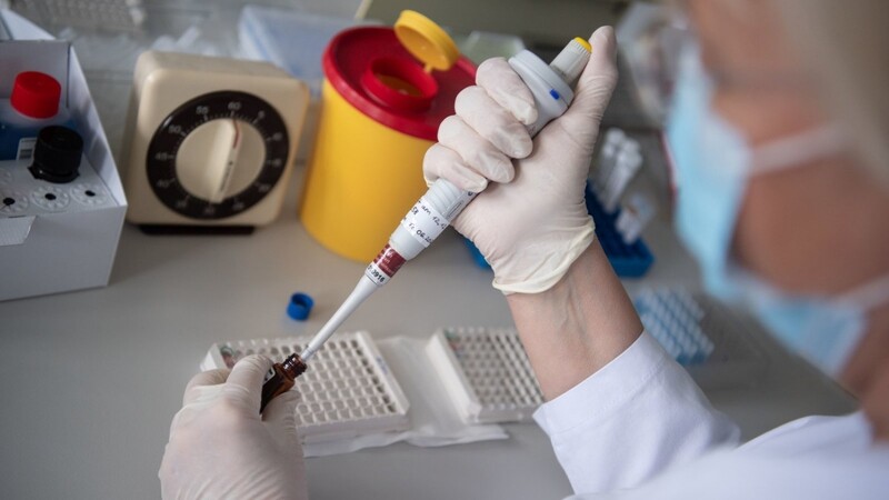 In vier Gemeinden sollen rund 8000 Menschen einen Antikörper-Test machen.