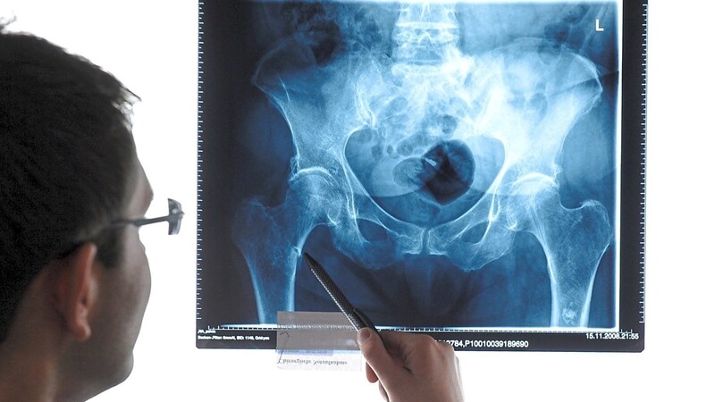 Aufgrund einer riesigen Datenpanne kursierten Patientendaten - darunter auch Röntgenbilder, wie hier zu sehen - ungeschützt im Internet.
