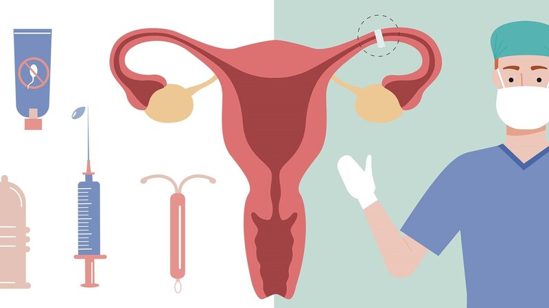 Die weibliche Sterilisation ist weltweit die häufigste Verhütungsmethode. Dabei werden die Eileiter verschlossen oder ganz entfernt.
