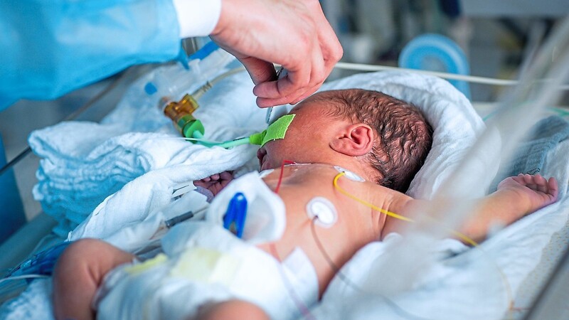 Ein zu früh geborenes Baby wird auf einer Perinatalstation versorgt.