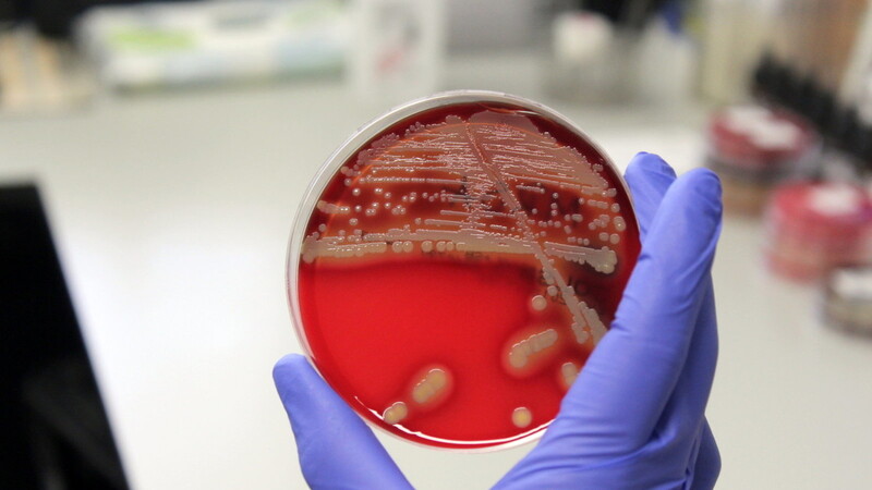 MRSA-Keime besiedeln eine Petrischale, aufgenommen im Labor der Klinik Mallersdorf.