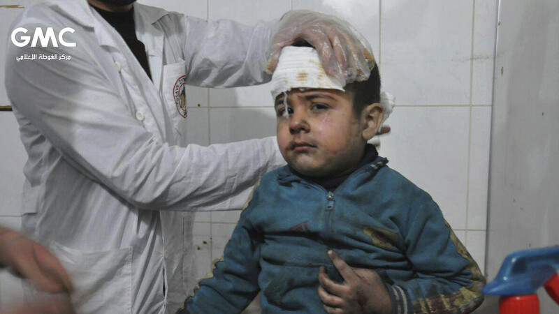 Dieses Bild zeigt einen syrischen Jungen, der während des Angriffs der syrischen Luftwaffe auf Ost-Ghuta verwundet wurde.