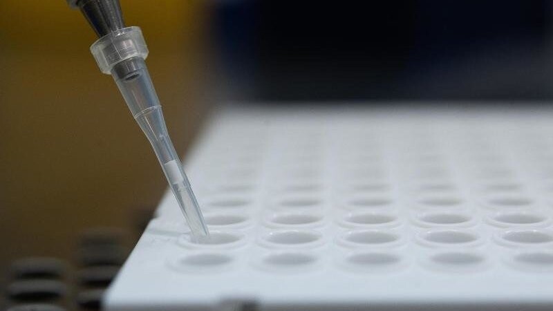 Ein PCR-Test in einem Labor in Stuttgart. Virologin Brinkmann fordert einen vermehrten Einsatz sogenannter Lollitests oder Gurgeltests. Diese können per PCR ausgewertet werden.
