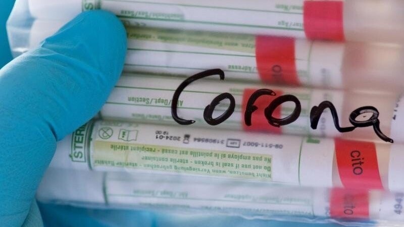 Proben für Corona-Tests werden für die weitere Untersuchung vorbereitet.