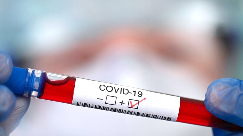 Die Zahl der Neuinfektionen mit Covid-19 steigt auch in Deutschland seit Wochen drastisch an. Doch wie verlässlich sind die Testergebnisse? (Symbolbild)
