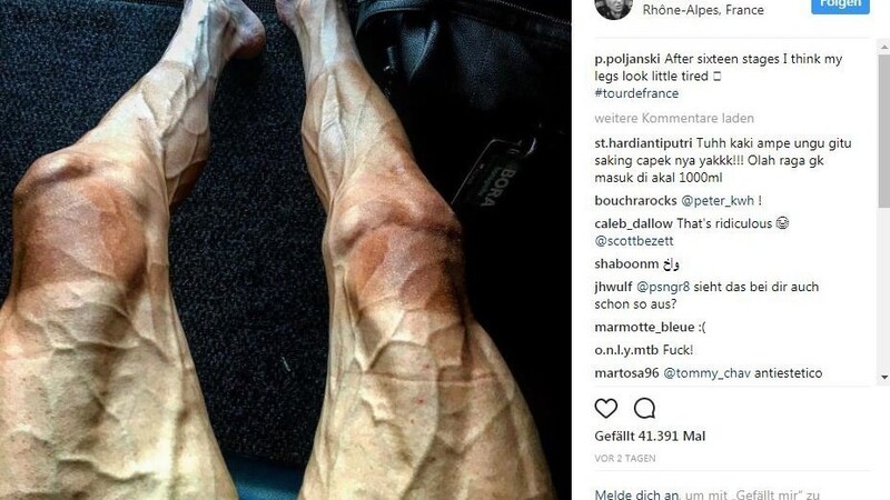Mit diesem Foto seiner Beine sorgt der Radprofi Pawel Poljanski gerade für Aufsehen in den sozialen Netzwerken.