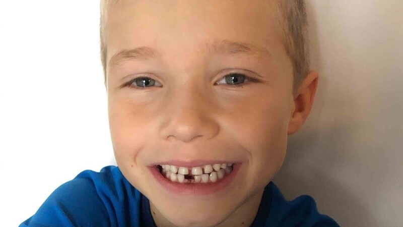 Stolz auf seine erste Zahnlücke: der siebenjährige Sidney Stüllenberg aus Salching. Den Milchzahn zog sich der Bub auf kuriose Art und Weise selbst.