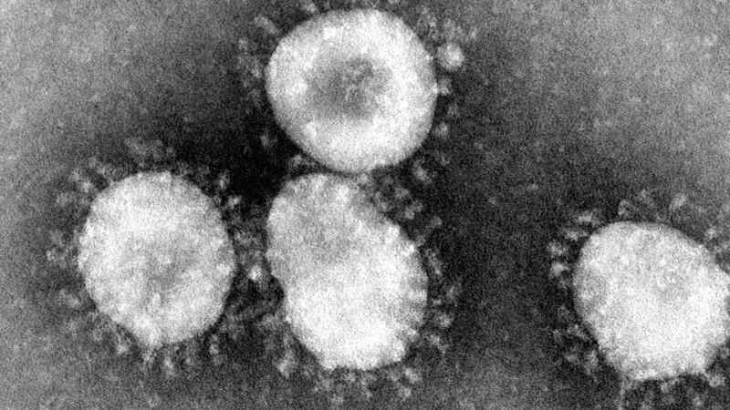 Ein Coronavirus unter dem Mikroskop.