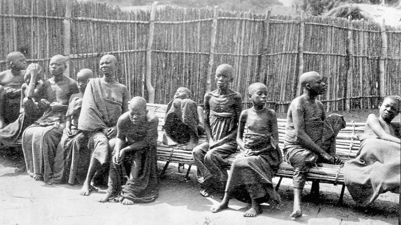 Originalfoto aus einem der Lager in Deutsch-Ostafrika: Menschen, die an der Schlafkrankheit leiden, dämmern vor sich hin. Viele werden nicht überleben.