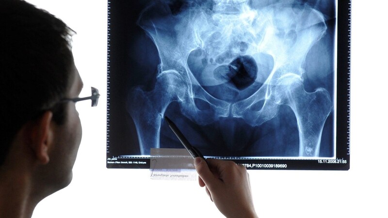 Aufgrund einer riesigen Datenpanne kursierten Patientendaten - darunter auch Röntgenbilder, wie hier zu sehen - offen im Netz.