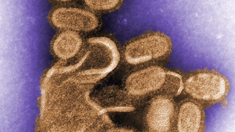 Das eingefärbte Bild, aufgenommen von der US-Seuchenkontrollbehörde CDC mit einem Transmissionselektronenmikroskop, zeigt das aus einer überlebenden Zellkultur zu Forschungszwecken nachgezüchtete Virus der Spanischen Grippe von 1918.