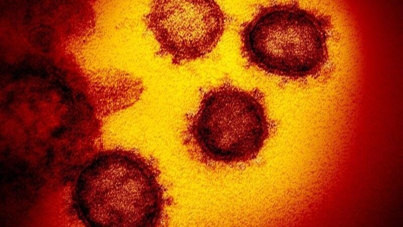 In Straubing sind drei weitere Menschen an den Folgen einer Infektion mit dem Coronavirus gestorben (Symbolbild).