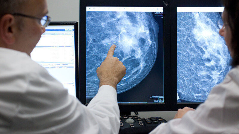 Der Radiologe Dr. Walter Heindel deutet im Referenzzentrum Mammographie am Universitätsklinikum Münster (UKM) auf eine Auffälligkeit in einer weiblichen Brust, dargestellt auf einem Computermonitor.