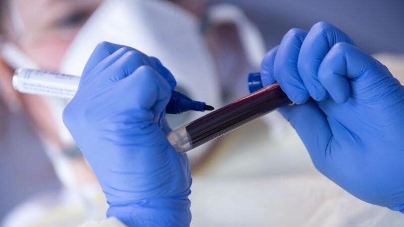 Ein Mitarbeiterin des Robert Koch-Instituts (RKI) beschriftet zum Start der Studie "Corona-Monitoring lokal" eine Blutprobe für einen Antikörpertest.