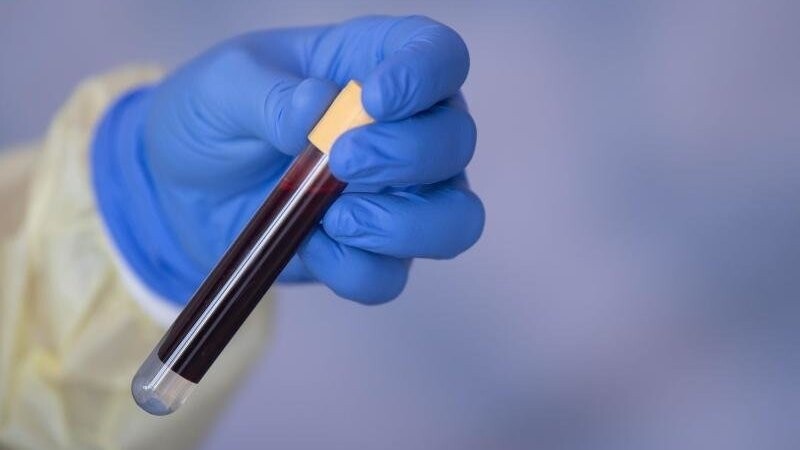 Eine Blutprobe für einen Antikörpertest beim RKI.