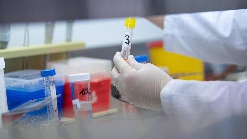 Eine Frau zeigt in einem Labor einen Test für das Coronavirus. Mittlerweile gibt es einen bestätigten Fall von Coronavirus in der Stadt Straubing. (Symbolbild)