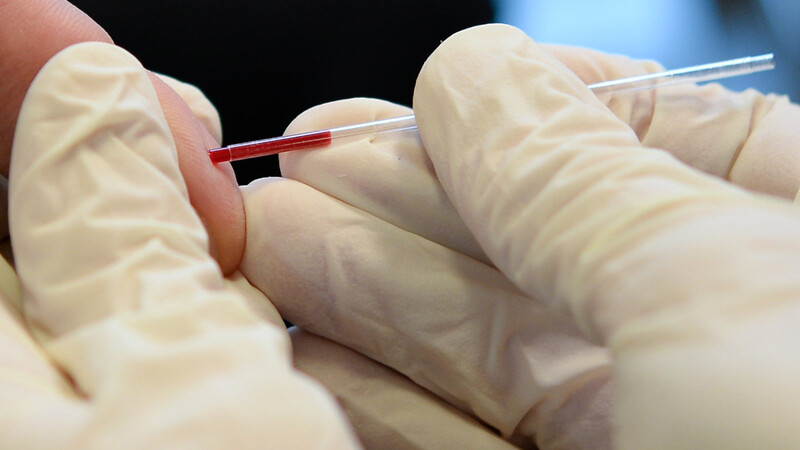 Für einen HIV-Test muss man sich nur etwas Blut abnehmen lassen.