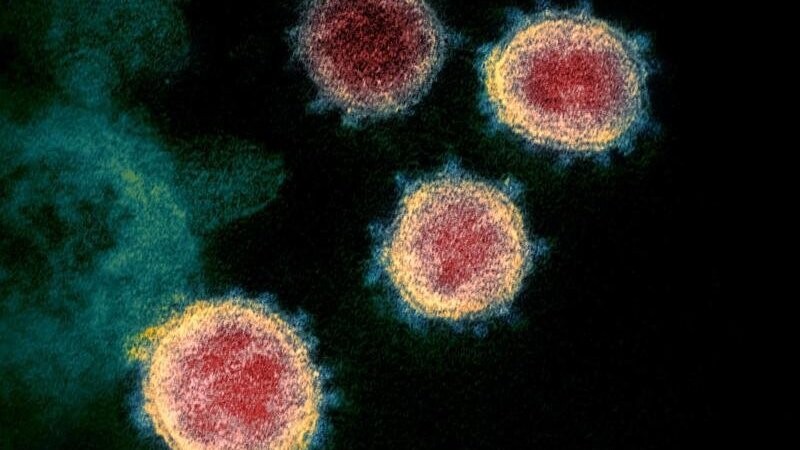 Undatierte elektronenmikroskopische Aufnahme, die vom U.S. National Institutes of Health im Februar 2020 zur Verfügung gestellt wurde, zeigt das Virus, das COVID-19 verursacht. Foto: Uncredited/NIAID-RML/via Ap/dpa/Archivbild