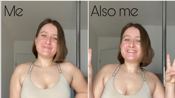 Heute: Selbstliebe, Veganismus, Gerechtigkeit und Umweltschutz sind die großen Themen auf Jasmins Profil.