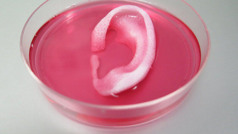 Ohrknorpel und Kieferknochen: Auch gr&ouml;&szlig;ere Teile lebenden Gewebes lassen sich inzwischen mit einem 3D-Drucker nachbilden.