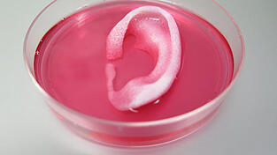 Ohrknorpel und Kieferknochen: Auch gr&ouml;&szlig;ere Teile lebenden Gewebes lassen sich inzwischen mit einem 3D-Drucker nachbilden.