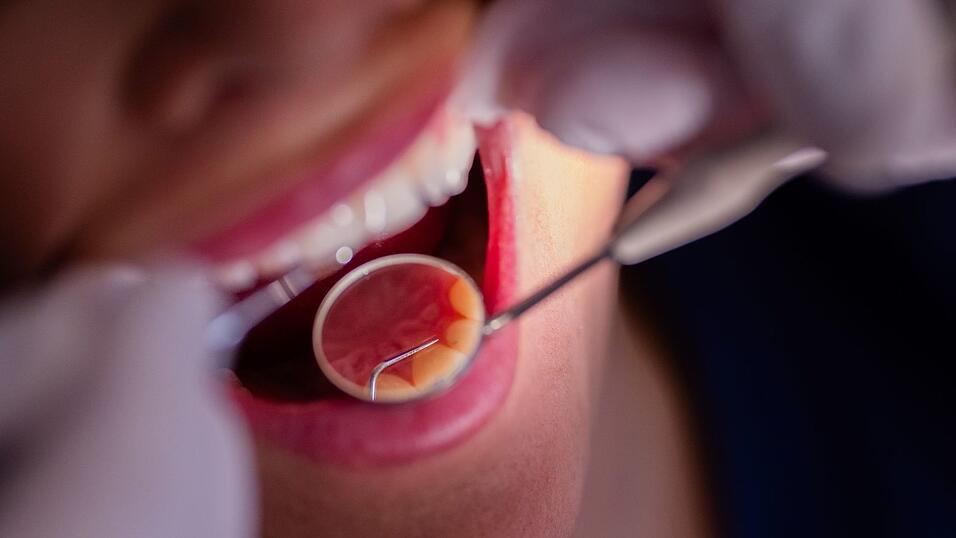 Zahnarztbehandlungen sollen nach dem Willen des CDU-Wirtschaftsrats &laquo;nicht l&auml;nger im Umlageverfahren den Beitragszahlern zur Last fallen&raquo;. (Symbolbild)