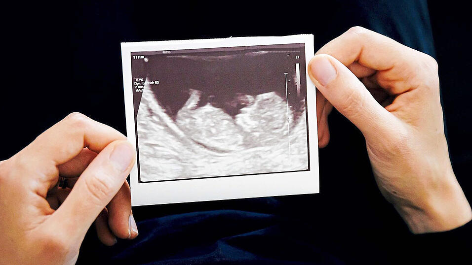 Schätzungsweise jede dritte Frau in Deutschland erleidet eine Fehlgeburt.