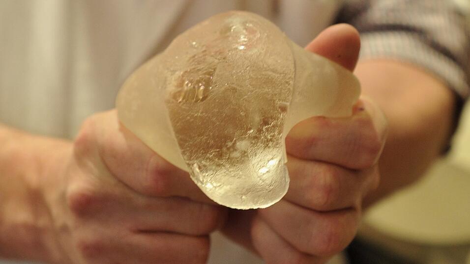 Ein defektes Silikonkissen der franz&ouml;sischen Billig-Brustimplantate-Firma Poly Implant Prothese (PIP), das zuvor aus der Brust einer Patientin entfernt wurde.