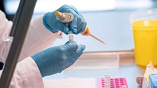 Eine Labormitarbeiterin im DNA-Labor des Bayerischen Landeskriminalamtes (LKA) bereitet eine DNA-Probe für die molekularbiologische Analyse vor.