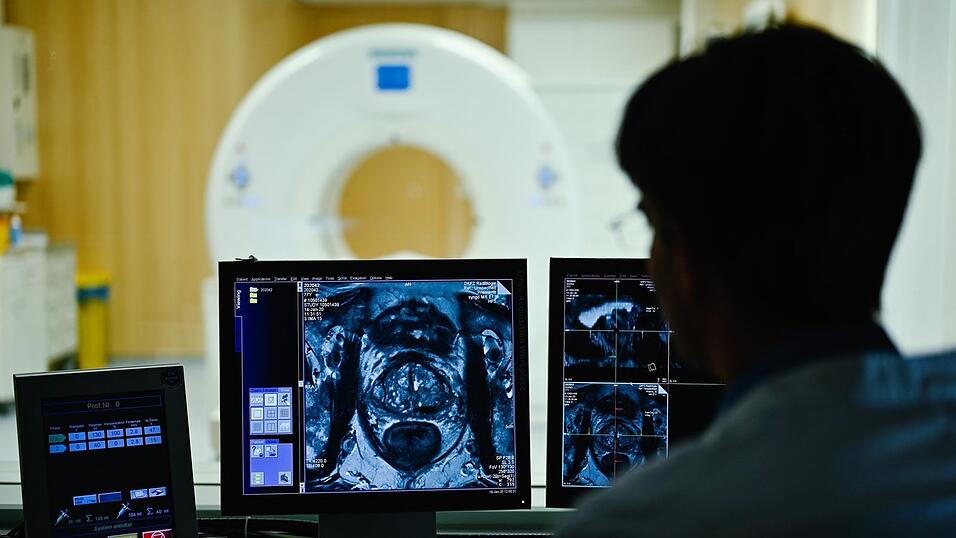 Ein Krankenhaus-Mitarbeiter betrachtet das Querschnittsbild einer Prostata. Prostatakrebs ist der bei Männern am häufigsten auftretende Krebs. Das Risiko steigt vor allem mit dem Alter. Ein Krankenhaus-Mitarbeiter betrachtet das Querschnittsbild einer Prostata. Prostatakrebs ist der bei Männern am häufigsten auftretende Krebs. Das Risiko steigt vor allem mit dem Alter.