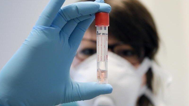 Ein neues Verfahren soll die Test-Kapazit&auml;ten deutlich steigern. (Symbolbild)