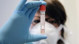 Ein neues Verfahren soll die Test-Kapazit&auml;ten deutlich steigern. (Symbolbild)