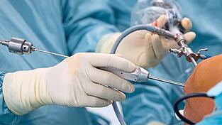 In den meisten Fällen geht alles gut: Ein Arzt operiert einen Patienten am Knie.