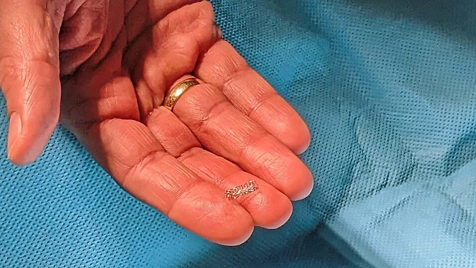 Winziger Lebensretter: Landrat Bernd Sibler hält einen Stent.