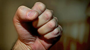 Mit der Faust verpasste der Angeklagte einem 31-Jährigen eine Platzwunde über der Augenbraue. (Symbolfoto) Mit der Faust verpasste der Angeklagte einem 31-Jährigen eine Platzwunde über der Augenbraue. (Symbolfoto)