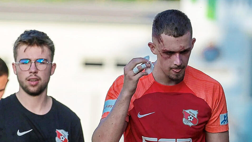Nach dem Zusammenprall mit einem Gegenspieler muss Hankofens David Schneider in Eichst&auml;tt mit einer blutenden Wunde am Kopf ausgewechselt werden. Nicht der einzige Verlust Hankofens an dem Abend.